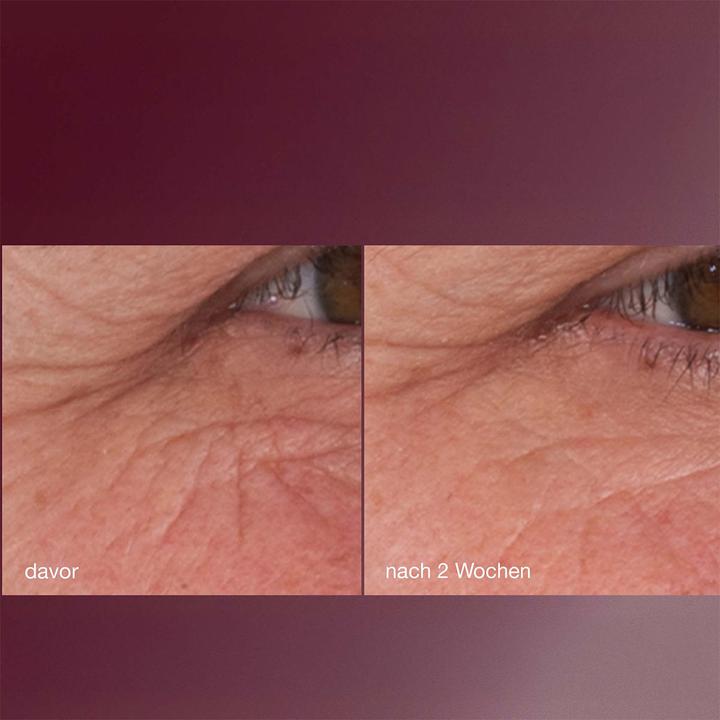 Actual product image Dermalogica dynamic skin retinol serum (30 ml)