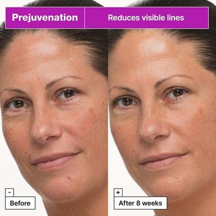 Actual product image Dr. Jart+ Dr.Jart+ Prejuvenation Cream (50 ml, Day cream)