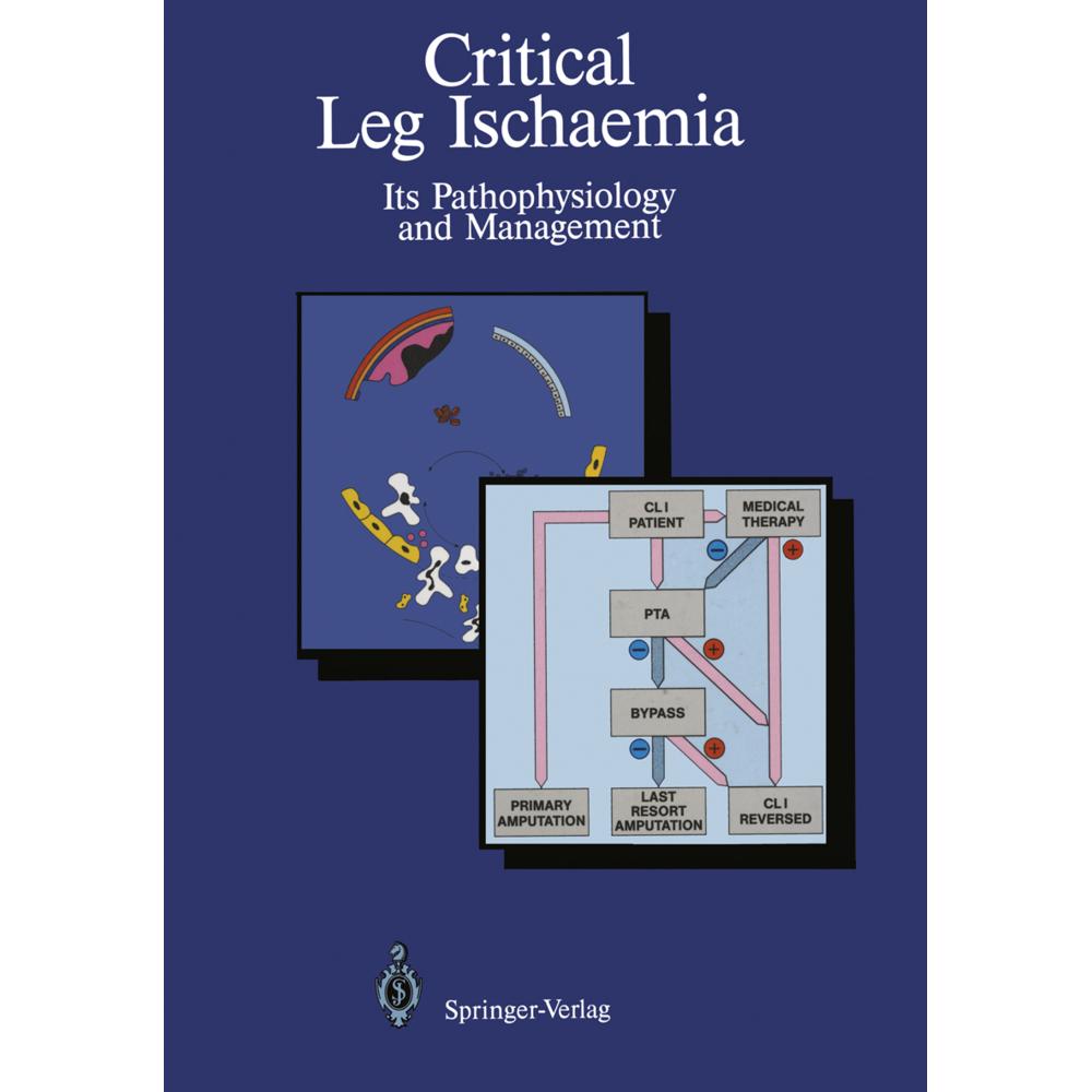 Critical Leg Ischaemia, Fachbücher von Günter Stock, John A. Dormandy