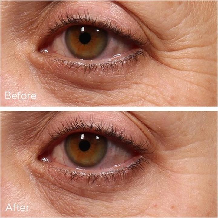 Image du produit Murad Augenserum (Soin des yeux Sérum, 15 ml, Jour + nuit)