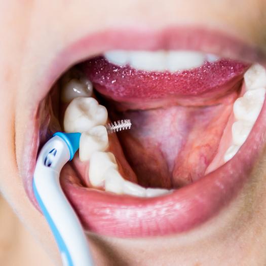 Actual product image Paro slider refill-brushes S (6 x, 2.50 mm)