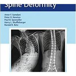 Thumbnail - Neuromuscular Spine Deformity, Fachbücher von Harry L. Shufflebarger, Peter O. Newton, Randal R. Betz, Amer F. Samdani, ...