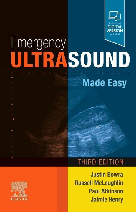 Produktbild Emergency Ultrasound Made Easy (Englisch, Paul Atkinson, Russell McLaughlin, Justin Bowra, Jamie Henry, 2021)