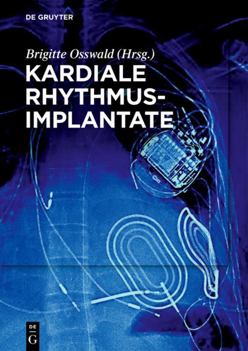 Produktbild Kardiale Rhythmusimplantate (Deutsch, 2019)