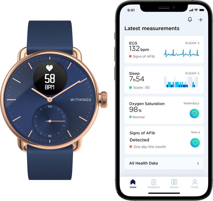 Produktbild Withings ScanWatch (38 mm, 4G)