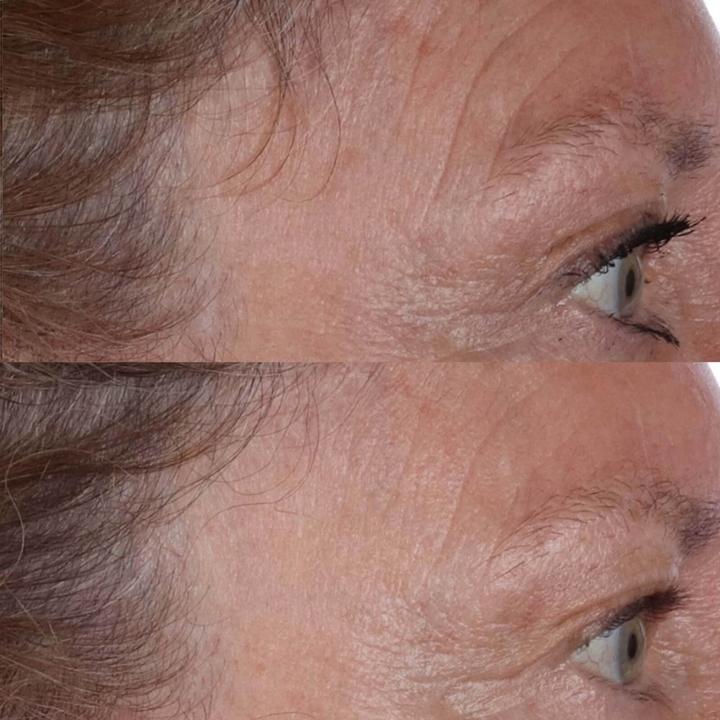 Actual product image Perricone MD Cold Plasma Plus+ The Essence (140 ml)