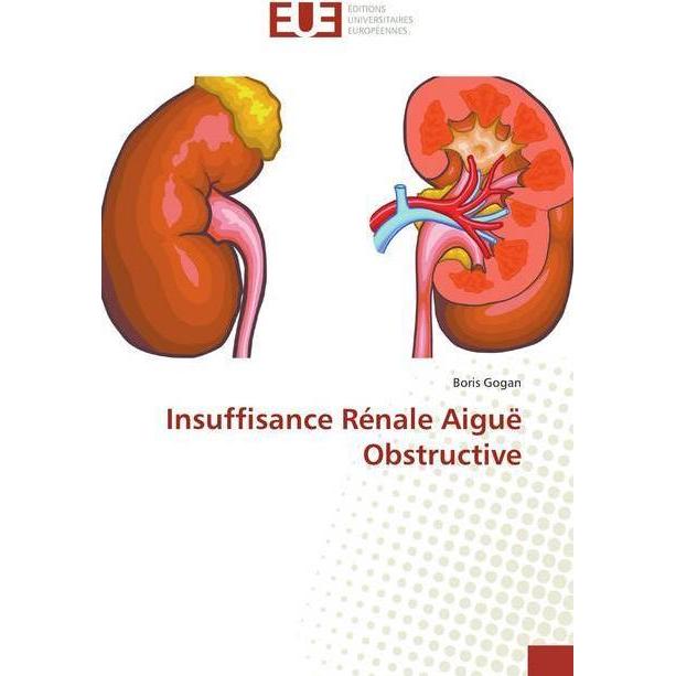 Insuffisance Rénale Aiguë Obstructive, Fachbücher von Boris Gogan
