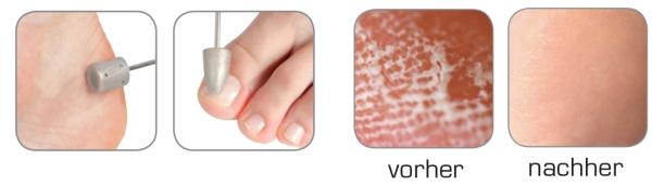 Immagine prodotto Promed Dispositivo per calli Pedimed incl. accessori da 35 pezzi