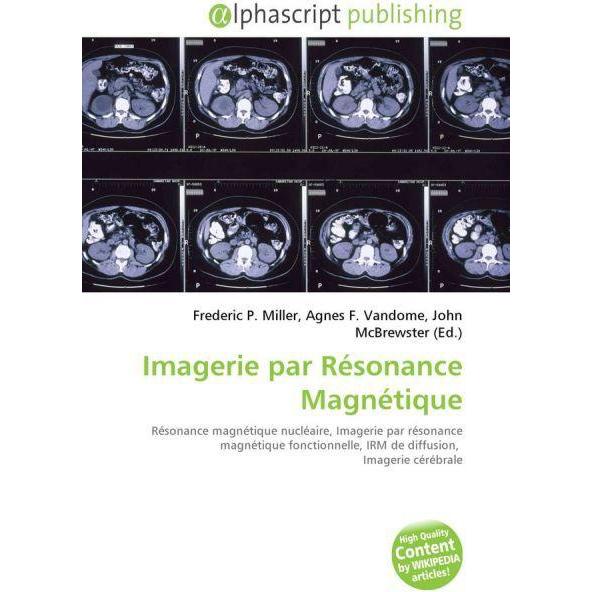 Imagerie par Résonance Magnétique, Ratgeber von Agnes F. Vandome, Frederic P. Miller, John McBrewster