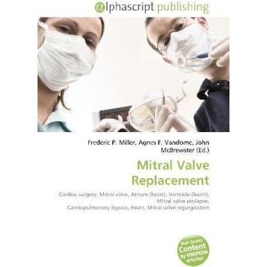 Mitral Valve Replacement, Fachbücher von Agnes F. Vandome, Frederic P. Miller, John McBrewster