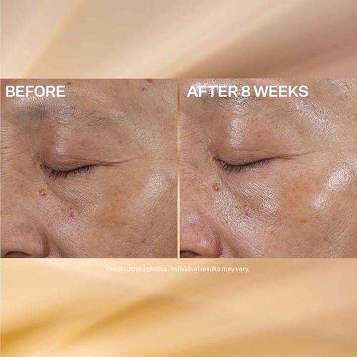 Actual product image StriVectin Super-C Eye Vitamin C Eye Cream Brightening & Firming (Eye Care Cream, 15 ml, Day)