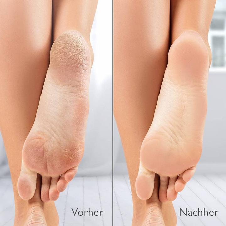 Produktbild Silk'n Hornhautentferner-Aufsatz VacuPedi Filter (4x)