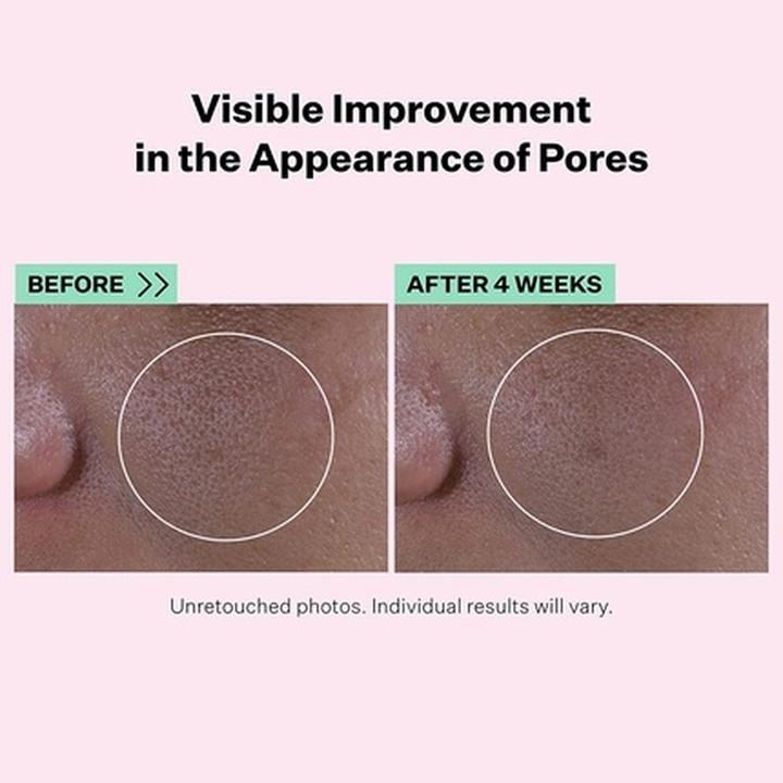 Actual product image StriVectin Super Shrink Pore Minimising Serum (30 ml, 24h cream)