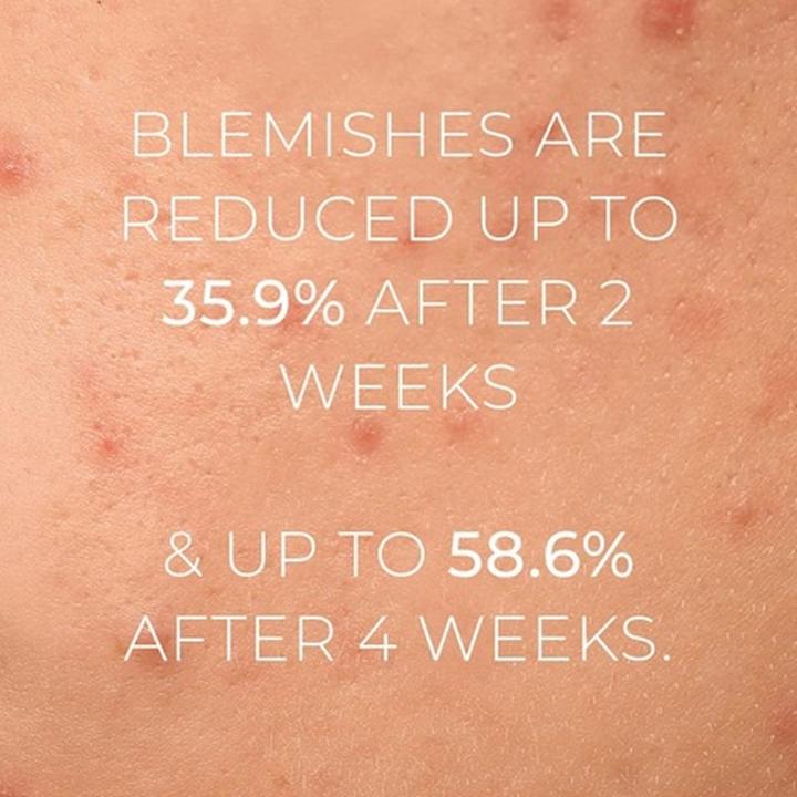 Actual product image Oskia Violet Water BHA Clarifying Treatment Tonic (Face toner, 100 ml)