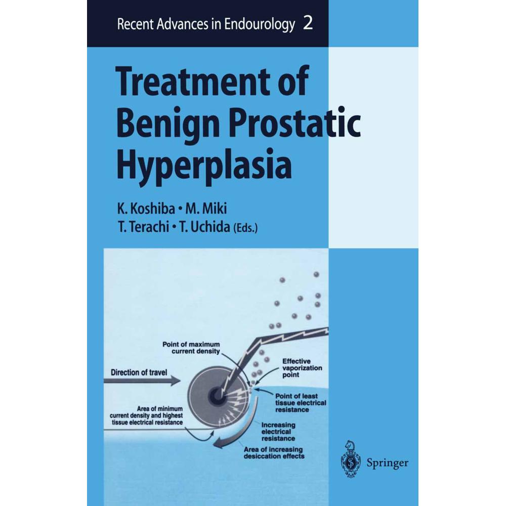 Treatment of Benign Prostatic Hyperplasia, Fachbücher