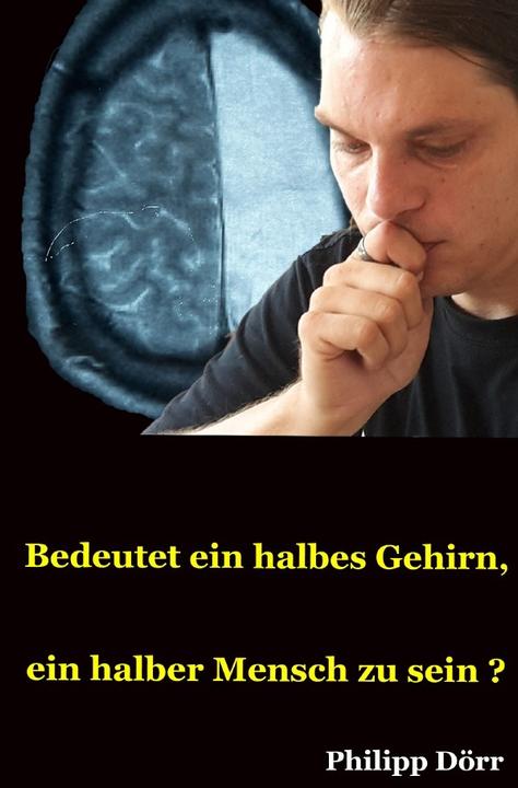 Produktbild Bedeutet ein halbes Gehirn, ein halber Mensch zu sein? (Philipp Dörr, Deutsch)