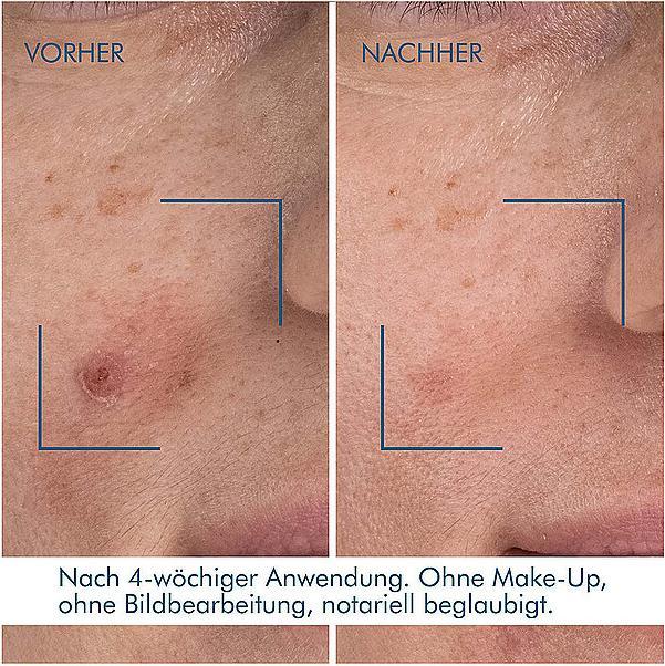 Produktbild Biotherm Blue Retinol (30 ml)