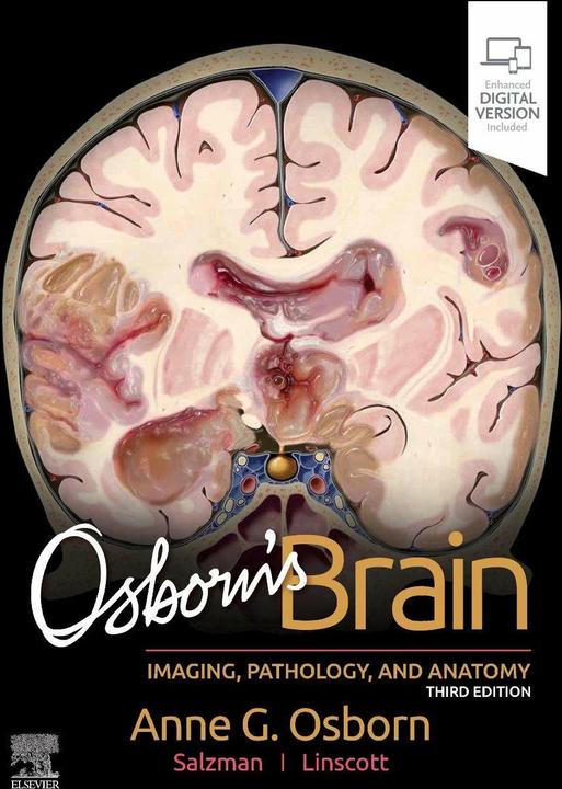 Actual product image Osborn's Brain (English, Anne G. Osborn, Karen L. Salzman, Luke L. Linscott, 2023)