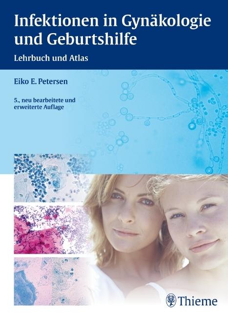 Produktbild Infektionen in Gynäkologie und Geburtshilfe (Deutsch, 2010)