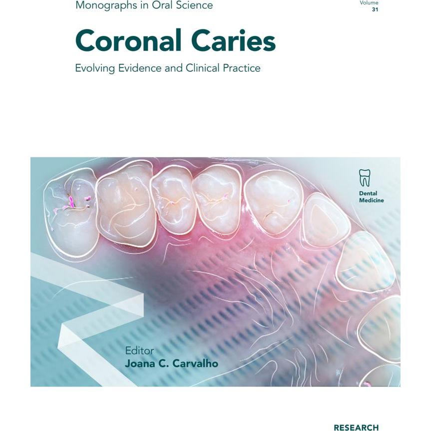 Coronal Caries, Ratgeber von Marilia A.R. Buzalaf, Adrian Lussi, Joana Christina Carvalho