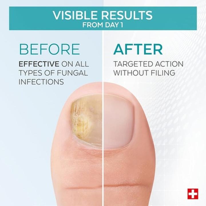 Produktbild Poderm Ongles Purifiante (8 ml)