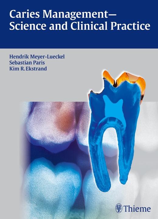 Produktbild Caries Management - Science and Clinical Practice (Englisch, Hendrik Meyer-Lückel, Kim Ekstrand, Sebastian Paris, 2013)