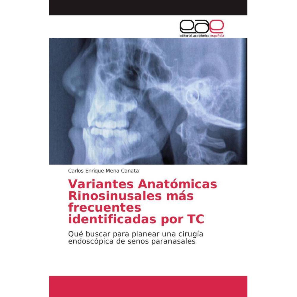 Variantes Anatómicas Rinosinusales más frecuentes identificadas por TC, Fachbücher von Carlos Enrique Mena Canata