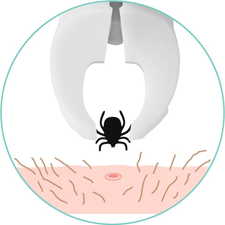 Actual product image TickSafe Zeckengreifer