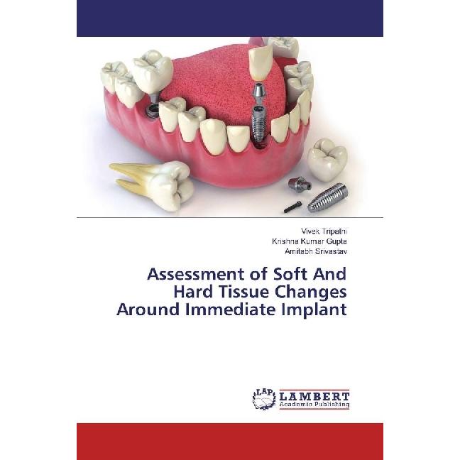 Assessment of Soft And Hard Tissue Changes Around Immediate Implant, Sachbücher von Amitabh Srivastav, Krishna Kumar Gup...