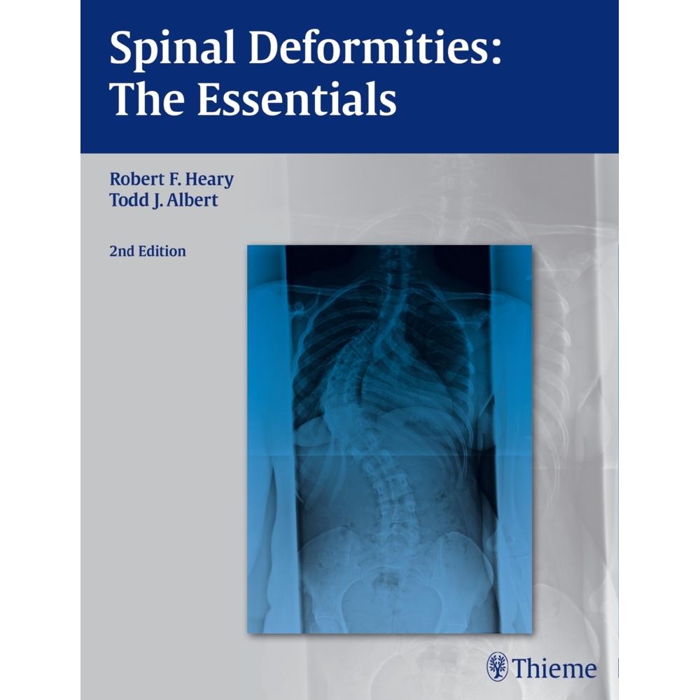 Heary:Spinal Deformities, Ratgeber von Robert F. Heary, Todd J. Albert