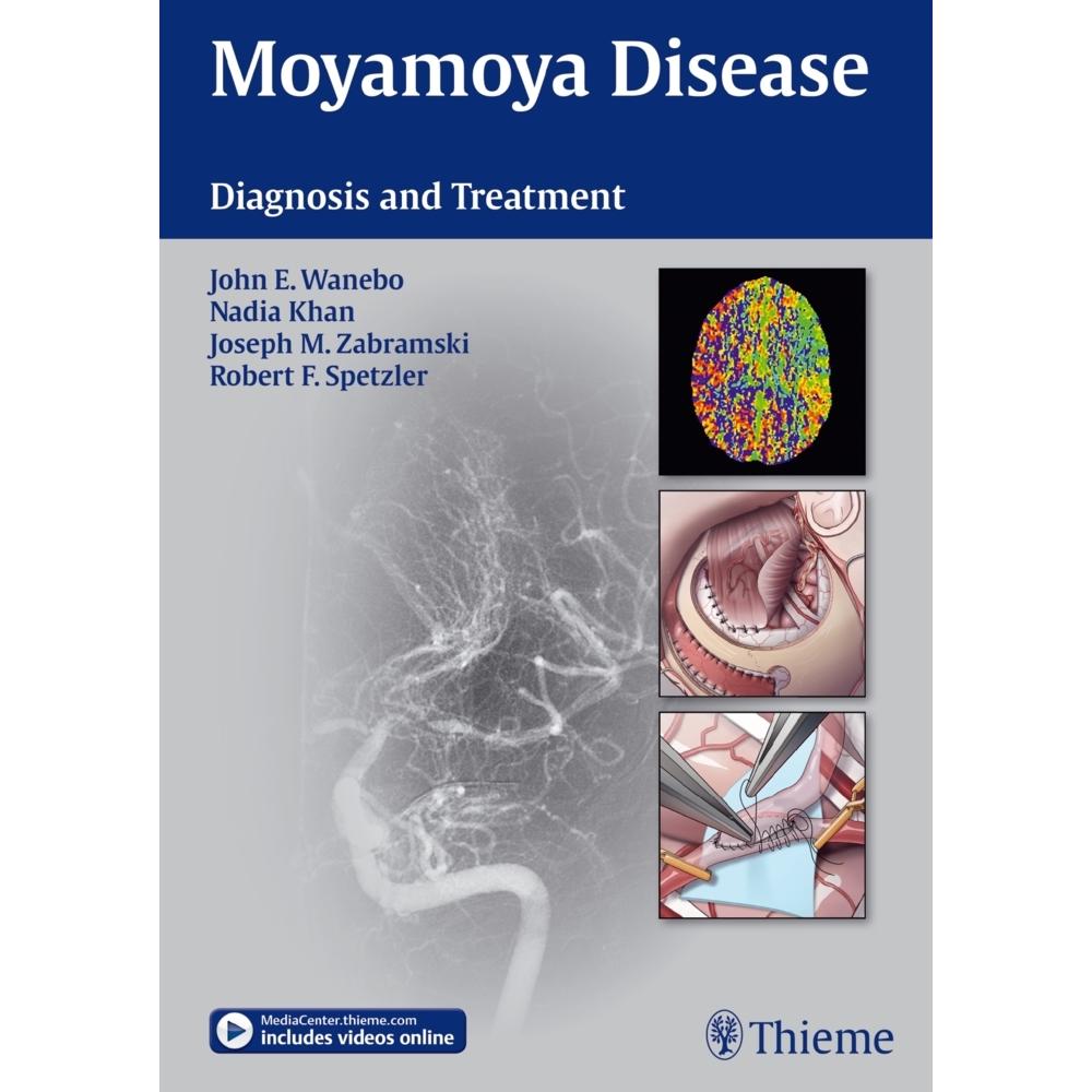 Moyamoya Disease, Sachbücher