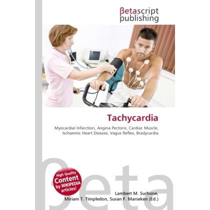 Tachycardia, Ratgeber von Susan F. Marseken, Lambert M. Surhone, Miriam T. Timpledon