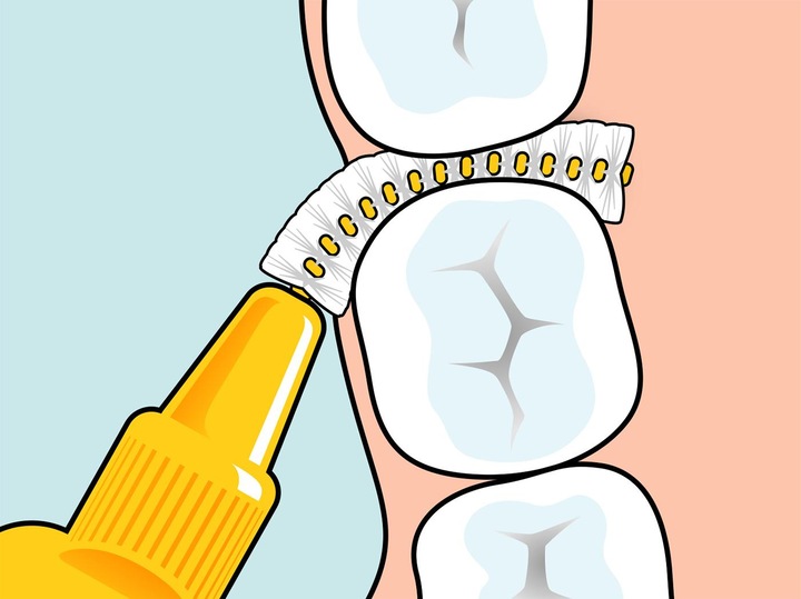 Actual product image TePe Interdental brushes Original (20 x, 0.45 mm)