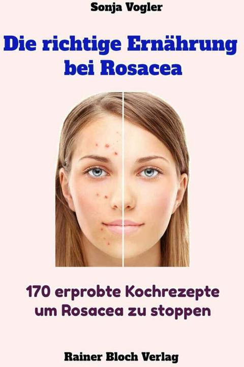 Actual product image Die richtige Ernährung bei Rosacea (German, Sonja Vogler, 2020)