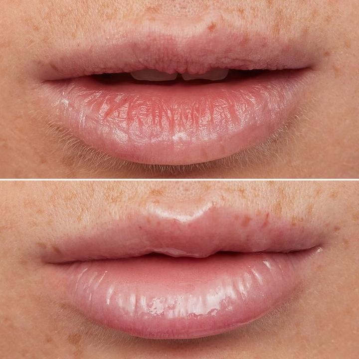 Actual product image Wonderskin Lip Rehab Therapy Oil Clear (Lip oil, 3.57 ml)