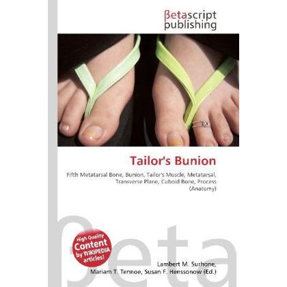 Tailor's Bunion, Fachbücher von Lambert M. Surhone, Miriam T. Timpledon, Susan F. Marseken