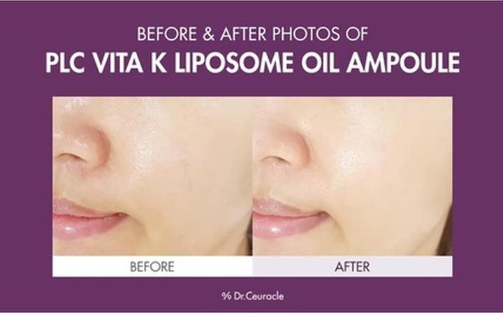 Image du produit Leegeehaam PLC Vitamine K Liposome Oil Ampoule Special Care for Toning, Glowing, Hydration, Brightening (50 ml)