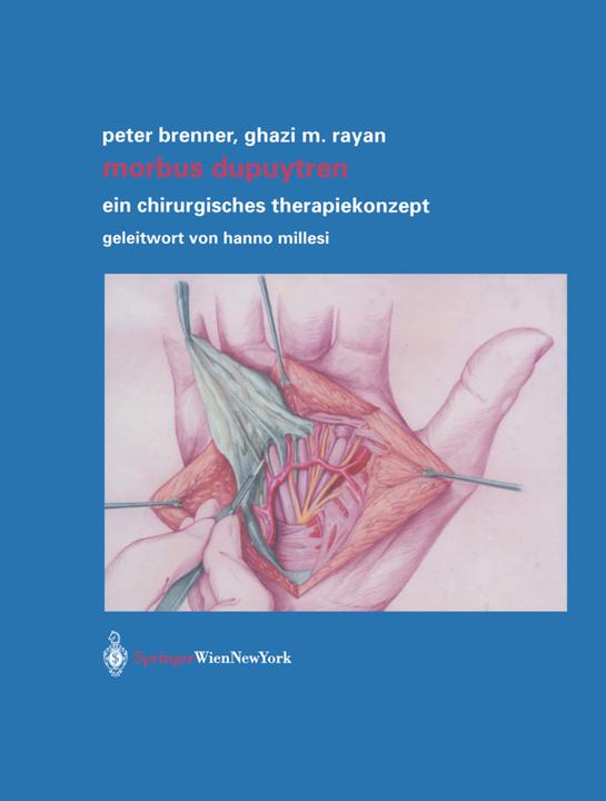 Produktbild Morbus Dupuytren (Deutsch, Ghazi M. Rayan, Peter Brenner, 2011)