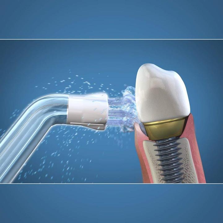 Actual product image Waterpik PS-100 Plaque Seeker (Oral irrigator attachments)
