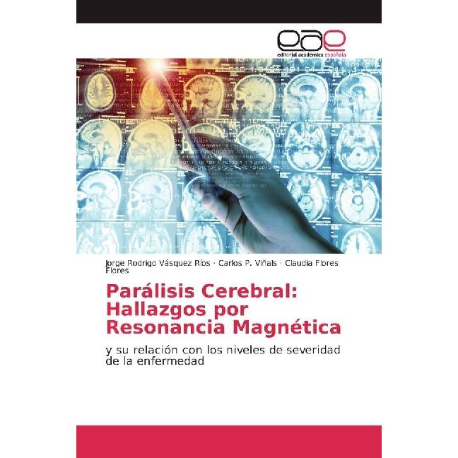 Parálisis Cerebral: Hallazgos por Resonancia Magnética, Fachbücher von Carlos P. Viñals, Claudia Flores Flores, Jorge Ro...