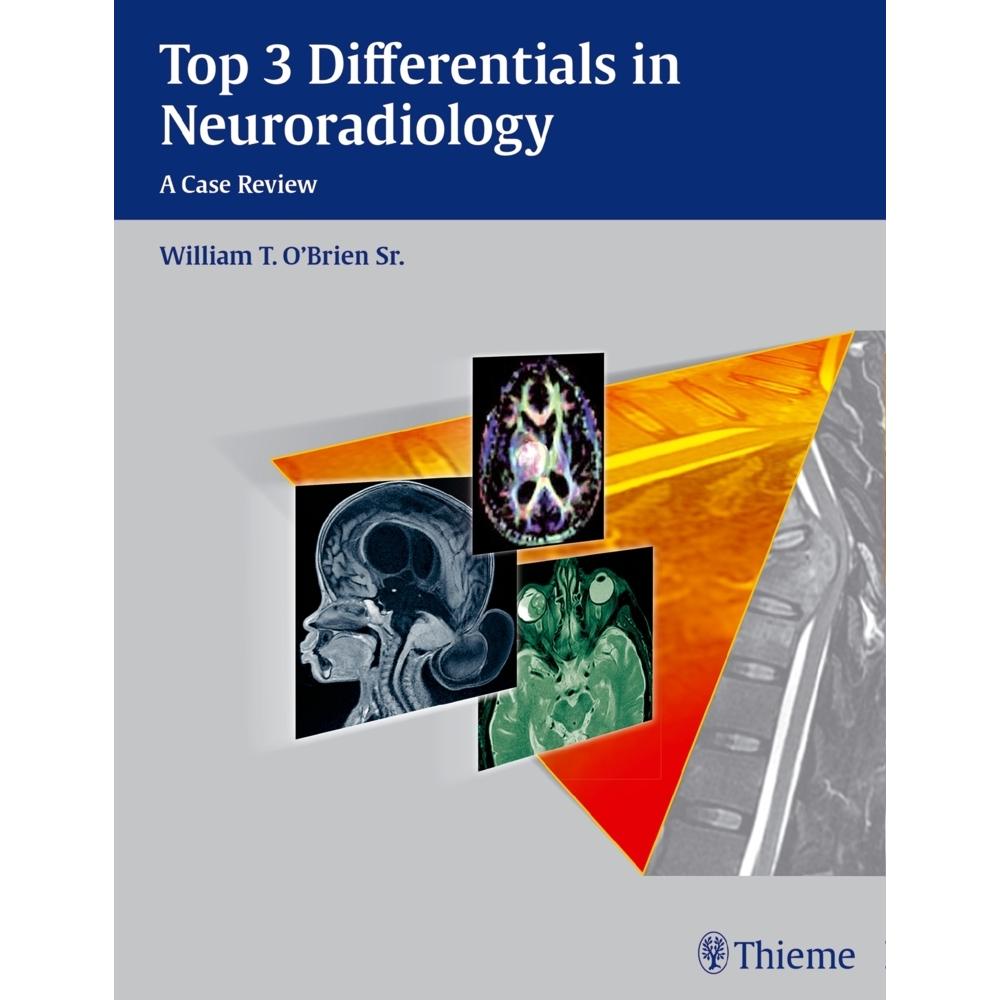 Top 3 Differentials in Neuroradiology, Fachbücher von William T. O'Brien