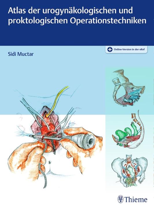Produktbild Atlas der urogynäkologischen und proktologischen Operationstechniken (Deutsch, Sidi Muctar, 2017)