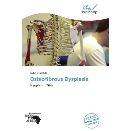 Osteofibrous Dysplasia, Fachbücher von Jody Cletus