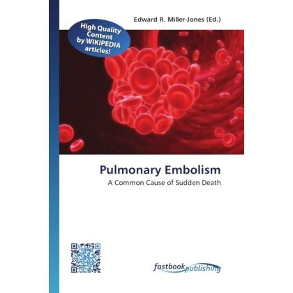 Pulmonary Embolism, Fachbücher von Edward R. Miller-Jones