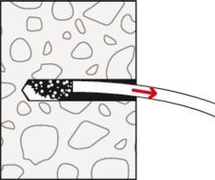 Productafbeelding Fischer Ankeravimo rinkinys FDBB 16/50 (1 Pcs.)