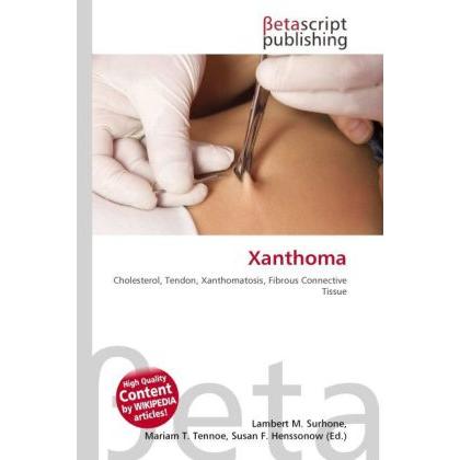Xanthoma, Fachbücher von Lambert M. Surhone, Mariam T. Tennoe, Susan F. Henssonow