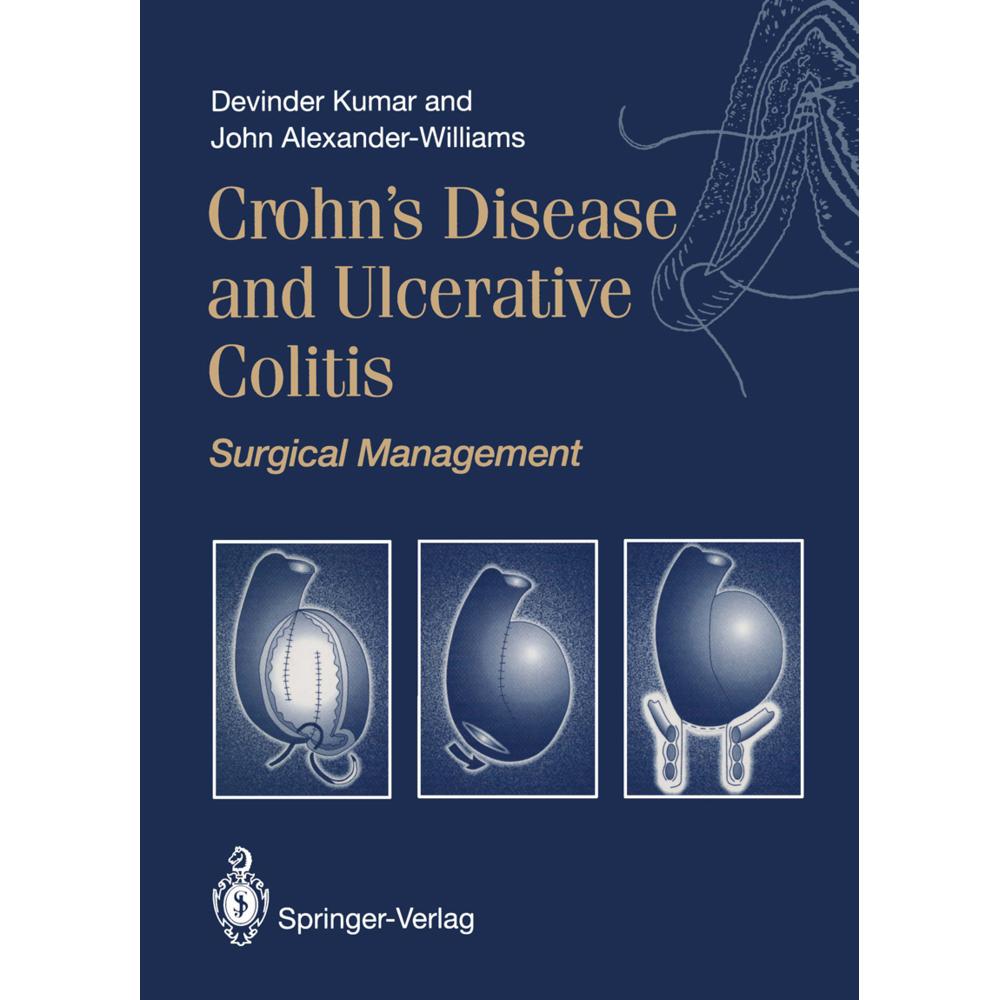 Crohn's Disease and Ulcerative Colitis, Fachbücher
