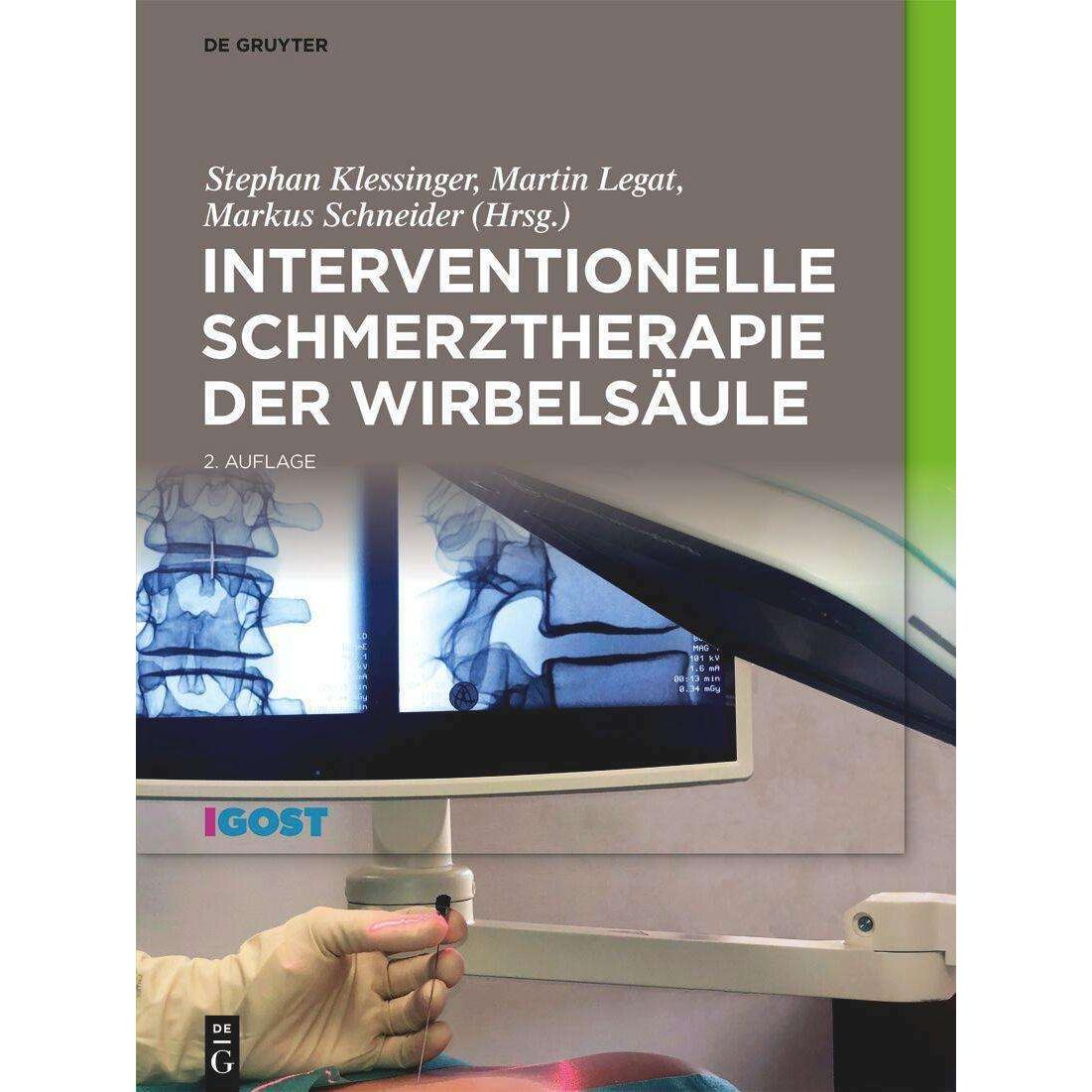 Interventionelle Schmerztherapie der Wi, Fachbücher von Markus Schneider, Stephan Klessinger, Martin Legat