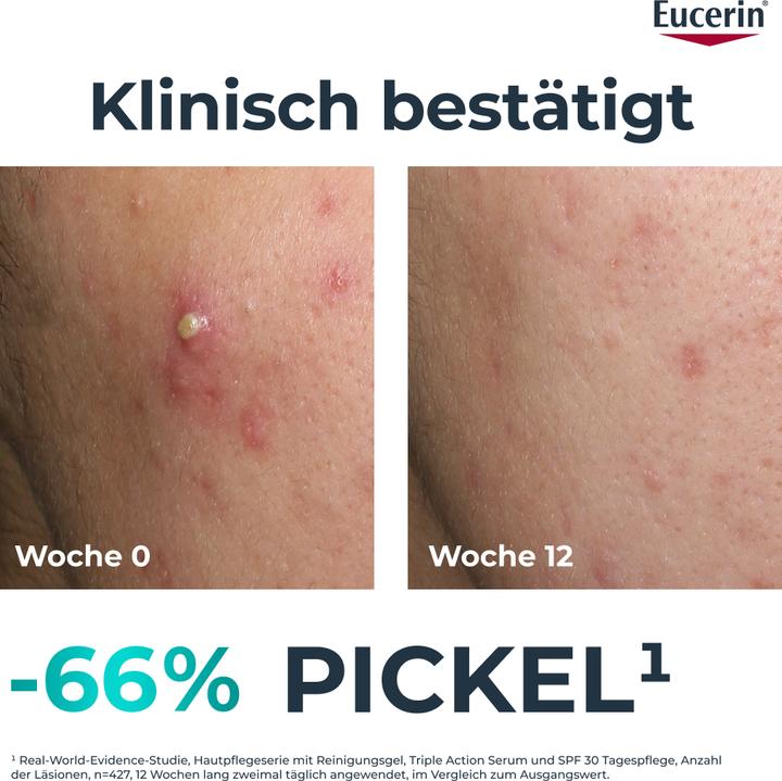 Image du produit Eucerin Dermopure Clinical Pflege 3-fach tiefenwirksam 40 ml (40 ml, Crème de jour)