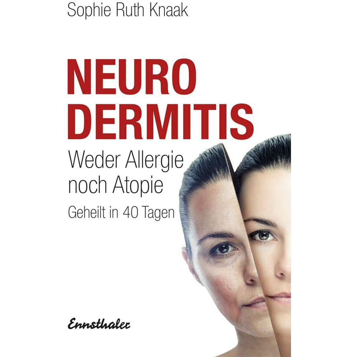 Neurodermitis, Fachbücher von Sophie Ruth Knaak